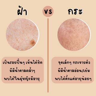 ภาพหน้าปกบทความ:title