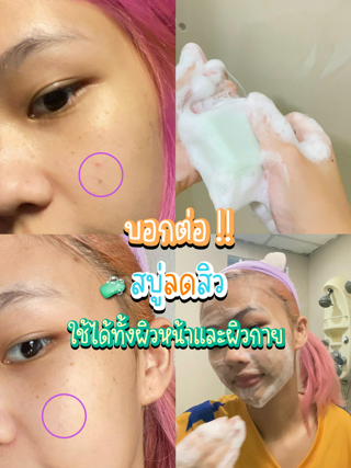 ภาพหน้าปกบทความ:title