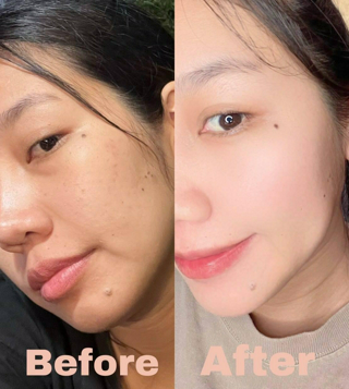 ภาพหน้าปกบทความ:title