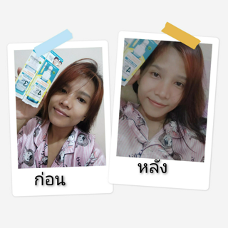 ภาพหน้าปกบทความ:title