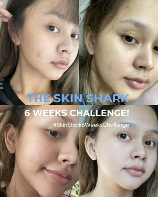 ภาพหน้าปกบทความ:title