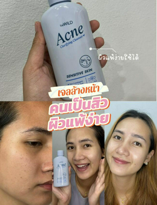 ภาพหน้าปกบทความ:title