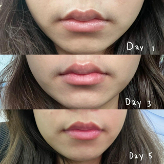 ภาพหน้าปกบทความ:title