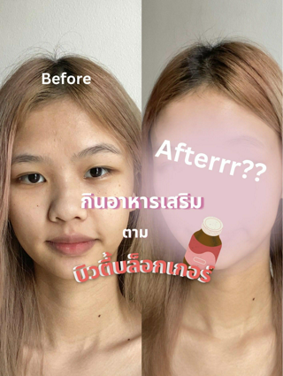 ภาพหน้าปกบทความ:title