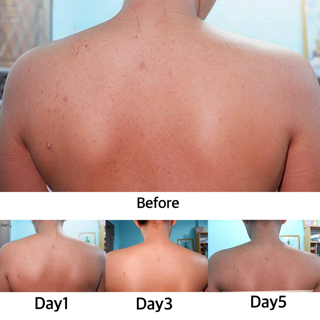 ภาพหน้าปกบทความ:title