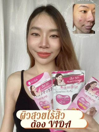 ภาพหน้าปกบทความ:title