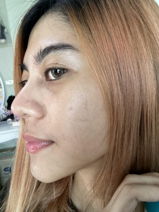 ภาพหน้าปกบทความ:title