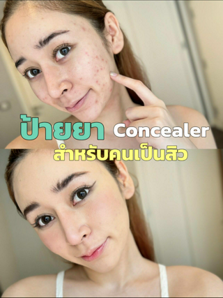 ภาพหน้าปกบทความ:title