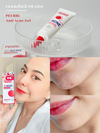 ภาพหน้าปกบทความ:title