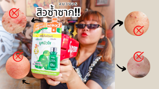 ภาพหน้าปกบทความ:title