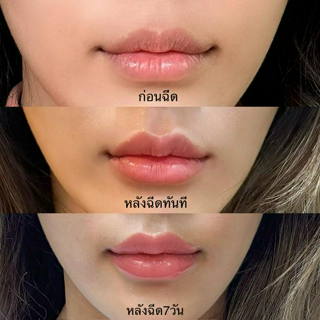 ภาพหน้าปกบทความ:title