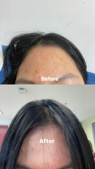 ภาพหน้าปกบทความ:title