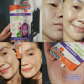 ภาพหน้าปกบทความ:title