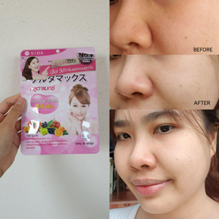 ภาพหน้าปกบทความ:title