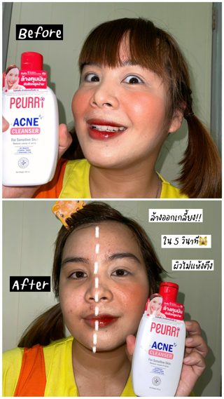 ภาพหน้าปกบทความ:title