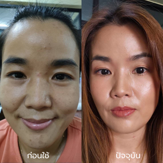 ภาพหน้าปกบทความ:title