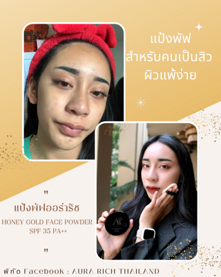 ภาพหน้าปกบทความ:title