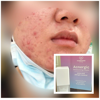 ภาพหน้าปกบทความ:title