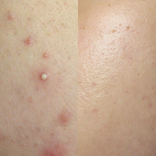 ภาพหน้าปกบทความ:title