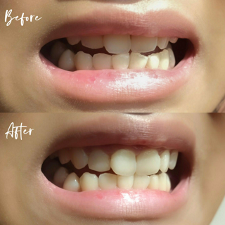 ภาพหน้าปกบทความ:title