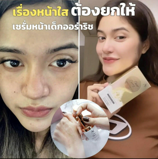 ภาพหน้าปกบทความ:title