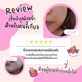 ภาพหน้าปกบทความ:title