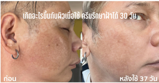 ภาพหน้าปกบทความ:title