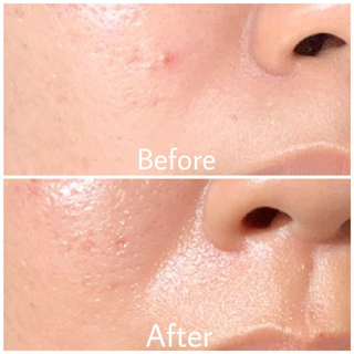 ภาพหน้าปกบทความ:title