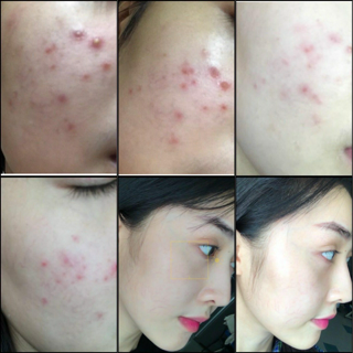 ภาพหน้าปกบทความ:title