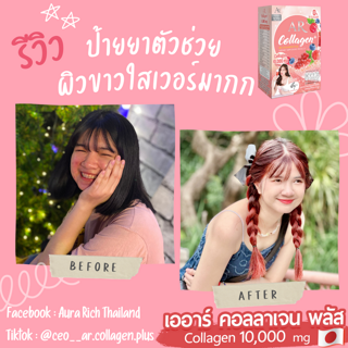 ภาพหน้าปกบทความ:title