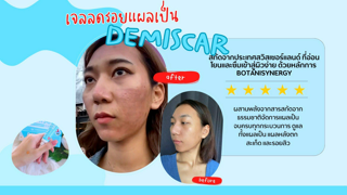 ภาพหน้าปกบทความ:title