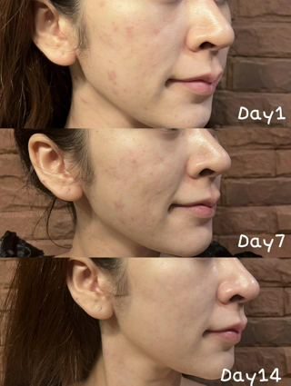 ภาพหน้าปกบทความ:title