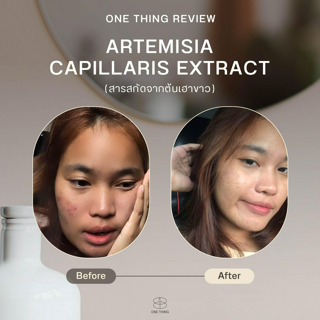 ภาพหน้าปกบทความ:title