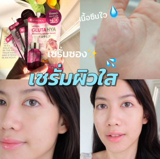 ภาพหน้าปกบทความ:title