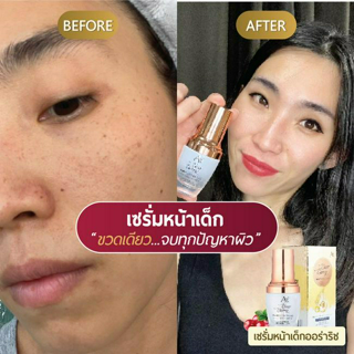 ภาพหน้าปกบทความ:title