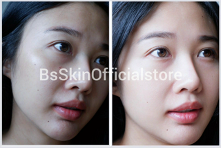 ภาพหน้าปกบทความ:title