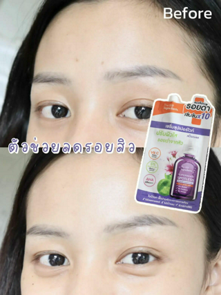 ภาพหน้าปกบทความ:title