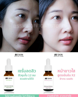 ภาพหน้าปกบทความ:title