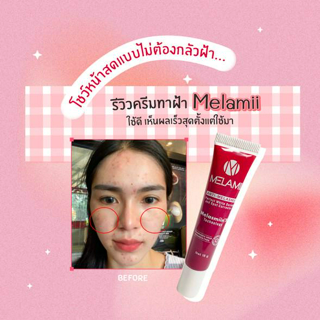 ภาพหน้าปกบทความ:title