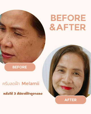 ภาพหน้าปกบทความ:title