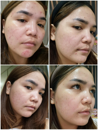 ภาพหน้าปกบทความ:title