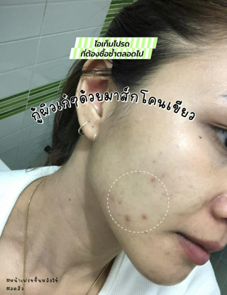 ภาพหน้าปกบทความ:title