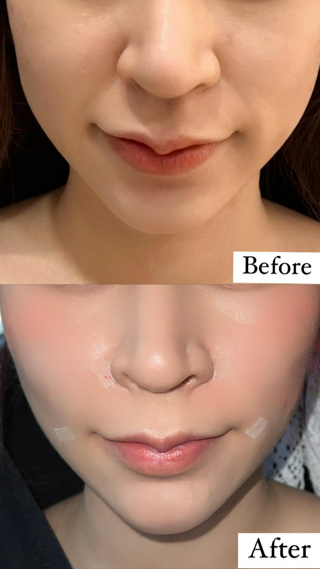 ภาพหน้าปกบทความ:title