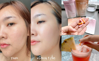 ภาพหน้าปกบทความ:title