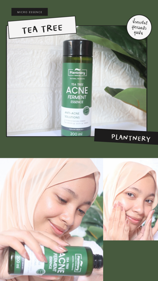 ภาพหน้าปกบทความ:title