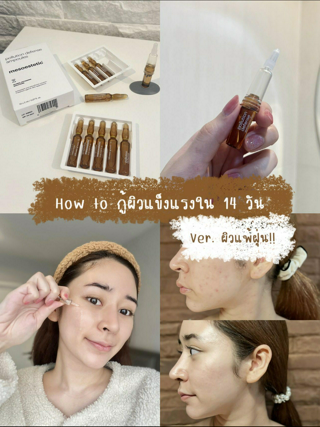 ภาพหน้าปกบทความ:title