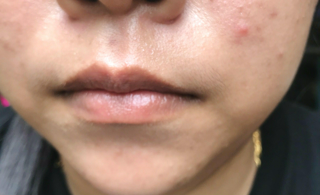 ภาพหน้าปกบทความ:title