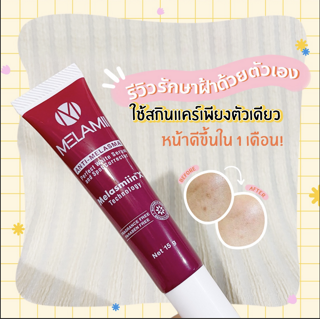 ภาพหน้าปกบทความ:title