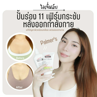 ภาพหน้าปกบทความ:title