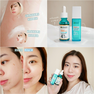 ภาพหน้าปกบทความ:title